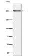 Mechanistic Target Of Rapamycin Kinase antibody, P00003, Boster Biological Technology, Western Blot image 