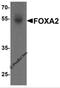 Forkhead Box A2 antibody, 7257, ProSci, Western Blot image 