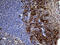 Protein Phosphatase 4 Regulatory Subunit 4 antibody, M14792, Boster Biological Technology, Immunohistochemistry paraffin image 