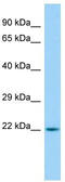 ADP Ribosylation Factor Like GTPase 15 antibody, TA331373, Origene, Western Blot image 