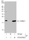 Cofilin 1 antibody, GTX632582, GeneTex, Immunoprecipitation image 