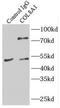 Collagen Type VIII Alpha 1 Chain antibody, FNab01847, FineTest, Immunoprecipitation image 