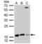 Destrin, Actin Depolymerizing Factor antibody, NBP2-16154, Novus Biologicals, Western Blot image 