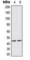 Mitogen-Activated Protein Kinase Kinase 1 antibody, LS-C354252, Lifespan Biosciences, Western Blot image 