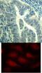 Cyclin Dependent Kinase 6 antibody, 79-249, ProSci, Immunohistochemistry paraffin image 
