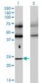 Transcription Factor EC antibody, H00022797-M08, Novus Biologicals, Western Blot image 