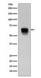 Matrix Metallopeptidase 14 antibody, M00656, Boster Biological Technology, Western Blot image 