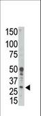 BCL2 Related Protein A1 antibody, LS-C98839, Lifespan Biosciences, Western Blot image 