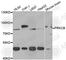 Protein Kinase C Beta antibody, A5845, ABclonal Technology, Western Blot image 