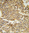 HIF1-alpha antibody, LS-C166866, Lifespan Biosciences, Immunohistochemistry paraffin image 