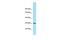 Aminoacylase 3 antibody, PA5-45361, Invitrogen Antibodies, Western Blot image 