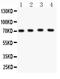 Potassium Voltage-Gated Channel Subfamily D Member 1 antibody, PB9256, Boster Biological Technology, Western Blot image 