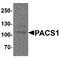 Phosphofurin Acidic Cluster Sorting Protein 1 antibody, TA349175, Origene, Western Blot image 