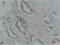 p21 antibody, STJ97470, St John