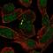 Senataxin antibody, HPA024105, Atlas Antibodies, Immunofluorescence image 