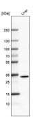 Retinol Dehydrogenase 16 antibody, NBP1-87117, Novus Biologicals, Western Blot image 