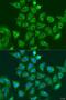 Ubiquitin-conjugating enzyme E2 A antibody, LS-C747628, Lifespan Biosciences, Immunofluorescence image 