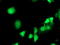 Eukaryotic Translation Initiation Factor 2B Subunit Gamma antibody, TA503758, Origene, Immunofluorescence image 