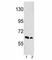 EPH Receptor A3 antibody, F50563-0.4ML, NSJ Bioreagents, Western Blot image 