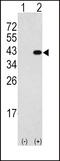 Death Associated Protein Kinase 2 antibody, LS-C100744, Lifespan Biosciences, Western Blot image 