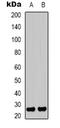 High Mobility Group Box 1 antibody, orb339062, Biorbyt, Western Blot image 