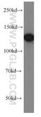 Protein Kinase N2 antibody, 14608-1-AP, Proteintech Group, Western Blot image 