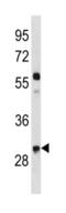 Cyclin D2 antibody, abx034759, Abbexa, Western Blot image 