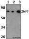 Zinc Finger Protein 7 antibody, A12285-1, Boster Biological Technology, Western Blot image 