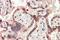 Teratocarcinoma-Derived Growth Factor 1 antibody, GTX88209, GeneTex, Immunohistochemistry paraffin image 