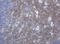 Mucin 16, Cell Surface Associated antibody, LS-C175568, Lifespan Biosciences, Immunohistochemistry frozen image 