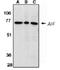 Apoptosis Inducing Factor Mitochondria Associated 1 antibody, ADI-AAP-015-E, Enzo Life Sciences, Western Blot image 