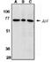 Apoptosis-inducing factor 1, mitochondrial antibody, ADI-AAP-015-E, Enzo Life Sciences, Western Blot image 