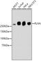 Filamin A antibody, 13-840, ProSci, Western Blot image 