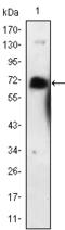 Nerve Growth Factor Receptor antibody, STJ98277, St John