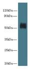 Glycerol Kinase 5 antibody, A59242-100, Epigentek, Western Blot image 