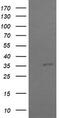 COP9 Signalosome Subunit 6 antibody, M08543, Boster Biological Technology, Western Blot image 