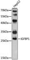 Insulin Like Growth Factor Binding Protein 1 antibody, 18-892, ProSci, Western Blot image 
