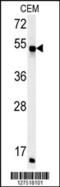 FKBP Prolyl Isomerase 8 antibody, 62-126, ProSci, Western Blot image 