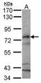 Carnitine Palmitoyltransferase 2 antibody, PA5-27999, Invitrogen Antibodies, Western Blot image 