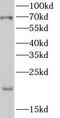 DNA Polymerase Lambda antibody, FNab10002, FineTest, Western Blot image 