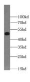 CUGBP Elav-Like Family Member 5 antibody, FNab00967, FineTest, Western Blot image 
