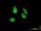 Rhox Homeobox Family Member 1 antibody, MA5-23128, Invitrogen Antibodies, Immunofluorescence image 