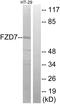 Frizzled Class Receptor 7 antibody, LS-C120598, Lifespan Biosciences, Western Blot image 