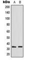 Growth Differentiation Factor 15 antibody, orb224056, Biorbyt, Western Blot image 