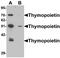 Thymopoietin antibody, A03278-1, Boster Biological Technology, Western Blot image 