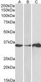 LIM and SH3 domain protein 1 antibody, PA5-17991, Invitrogen Antibodies, Western Blot image 