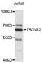 Ro60, Y RNA Binding Protein antibody, STJ25973, St John