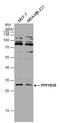 Protein Phosphatase 1 Regulatory Subunit 3B antibody, GTX131132, GeneTex, Western Blot image 