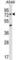 Acyl-CoA Synthetase Medium Chain Family Member 2A antibody, abx030539, Abbexa, Western Blot image 