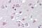 Fasciculation And Elongation Protein Zeta 1 antibody, MBS242651, MyBioSource, Immunohistochemistry paraffin image 